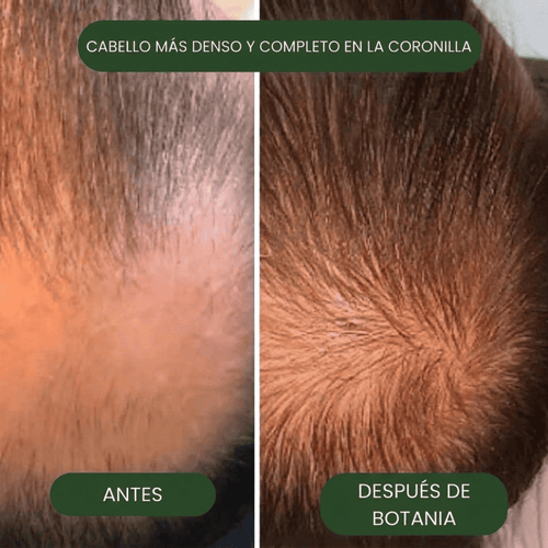 Botania™ | Aceite Crudo de Batana 100%